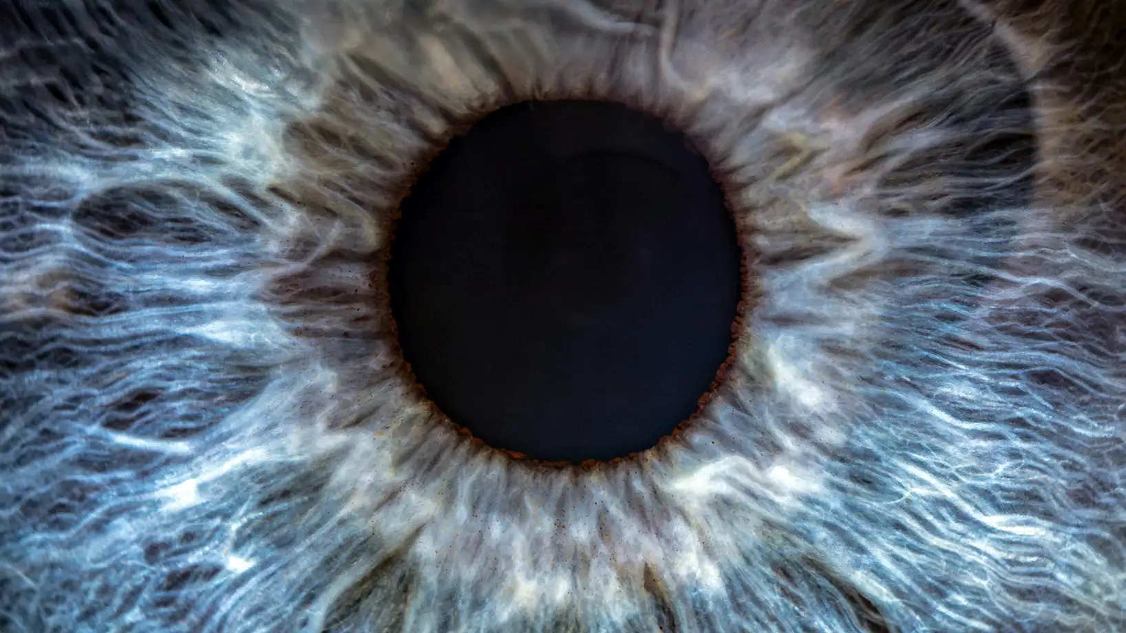 Laser excimer yag argon